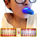 Kit de Clareamento Dental